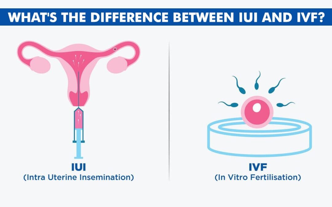 What’s the difference between IUI and IVF?