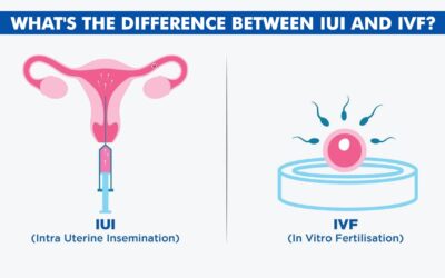 What’s the difference between IUI and IVF?