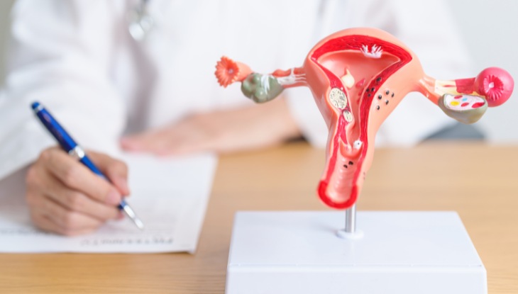 Female Reproductive Health: Understanding PCOD