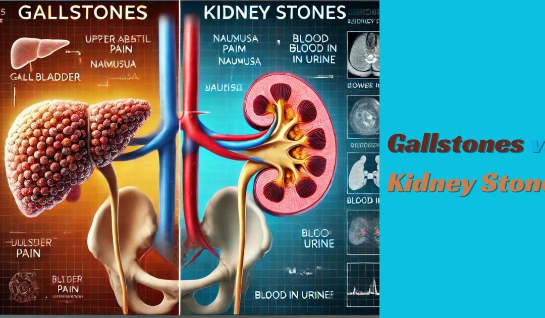 Gallstones vs. Kidney Stones: How to Tell the Difference